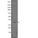 DF7600 at 1/100 staining Mouse testis tissue by IHC-P. The sample was formaldehyde fixed and a heat mediated antigen retrieval step in citrate buffer was performed. The sample was then blocked and incubated with the antibody for 1.5 hours at 22¡ãC. An HRP conjugated goat anti-rabbit antibody was used as the secondary