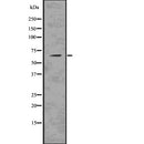 DF7602 at 1/100 staining Mouse testis tissue by IHC-P. The sample was formaldehyde fixed and a heat mediated antigen retrieval step in citrate buffer was performed. The sample was then blocked and incubated with the antibody for 1.5 hours at 22¡ãC. An HRP conjugated goat anti-rabbit antibody was used as the secondary