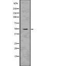 DF7605 at 1/100 staining Rat liver tissue by IHC-P. The sample was formaldehyde fixed and a heat mediated antigen retrieval step in citrate buffer was performed. The sample was then blocked and incubated with the antibody for 1.5 hours at 22¡ãC. An HRP conjugated goat anti-rabbit antibody was used as the secondary