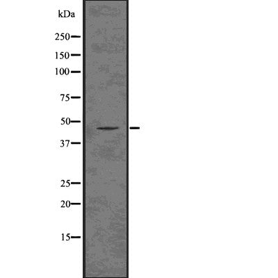 DF7608 at 1/200 staining  mouse brain tissue sections by IHC-P. The tissue was formaldehyde fixed and a heat mediated antigen retrieval step in citrate buffer was performed. The tissue was then blocked and incubated with the antibody for 1.5 hours at 22¡ãC. An HRP conjugated goat anti-rabbit antibody was used as the secondary