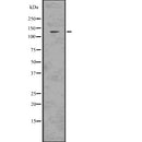 DF7613 staining COLO205 cells by IF/ICC. The sample were fixed with PFA and permeabilized in 0.1% Triton X-100,then blocked in 10% serum for 45 minutes at 25¡ãC. The primary antibody was diluted at 1/200 and incubated with the sample for 1 hour at 37¡ãC. An  Alexa Fluor 594 conjugated goat anti-rabbit IgG (H+L) antibody(Cat.