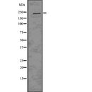 Western blot analysis of EIF4G1 using K562 whole  lysates.