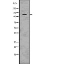 Western blot analysis of JAG2 using K562 whole  lysates.