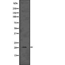 Western blot analysis of HRAS using HepG2 whole  lysates.