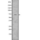 DF7620 at 1/100 staining Human pancreas tissue by IHC-P. The sample was formaldehyde fixed and a heat mediated antigen retrieval step in citrate buffer was performed. The sample was then blocked and incubated with the antibody for 1.5 hours at 22¡ãC. An HRP conjugated goat anti-rabbit antibody was used as the secondary