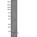Western blot analysis of TXN using COLO205 whole  lysates.