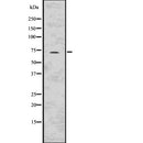 Western blot analysis of BIRC3 using Jurkat whole  lysates.