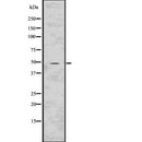 Western blot analysis of HTRA2 using COLO205 whole  lysates.