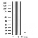 Western blot analysis of DAP using COLO205 whole cell lysates