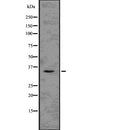 DF7629 at 1/100 staining Mouse liver tissue by IHC-P. The sample was formaldehyde fixed and a heat mediated antigen retrieval step in citrate buffer was performed. The sample was then blocked and incubated with the antibody for 1.5 hours at 22¡ãC. An HRP conjugated goat anti-rabbit antibody was used as the secondary