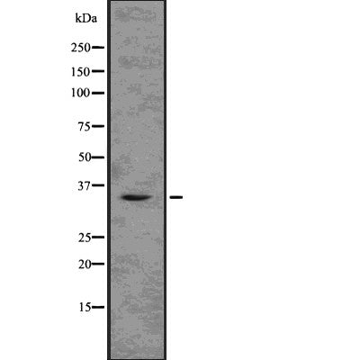 DF7629 at 1/100 staining Mouse liver tissue by IHC-P. The sample was formaldehyde fixed and a heat mediated antigen retrieval step in citrate buffer was performed. The sample was then blocked and incubated with the antibody for 1.5 hours at 22¡ãC. An HRP conjugated goat anti-rabbit antibody was used as the secondary