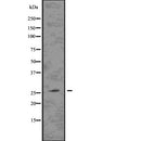 DF7630 staining NIH-3T3 by IF/ICC. The sample were fixed with PFA and permeabilized in 0.1% Triton X-100,then blocked in 10% serum for 45 minutes at 25¡ãC. The primary antibody was diluted at 1/200 and incubated with the sample for 1 hour at 37¡ãC. An  Alexa Fluor 594 conjugated goat anti-rabbit IgG (H+L) Ab, diluted at 1/600, was used as the secondary antibod