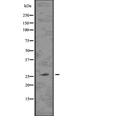 DF7630 staining NIH-3T3 by IF/ICC. The sample were fixed with PFA and permeabilized in 0.1% Triton X-100,then blocked in 10% serum for 45 minutes at 25¡ãC. The primary antibody was diluted at 1/200 and incubated with the sample for 1 hour at 37¡ãC. An  Alexa Fluor 594 conjugated goat anti-rabbit IgG (H+L) Ab, diluted at 1/600, was used as the secondary antibod
