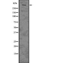 Western blot analysis of PLEC using Jurkat whole  lysates.