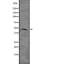 DF7632 staining  NIH-3T3 cells by IF/ICC. The sample were fixed with PFA and permeabilized in 0.1% Triton X-100,then blocked in 10% serum for 45 minutes at 25¡ãC. The primary antibody was diluted at 1/200 and incubated with the sample for 1 hour at 37¡ãC. An  Alexa Fluor 594 conjugated goat anti-rabbit IgG (H+L) antibody(Cat.