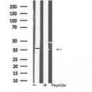 DF7634 staining A549 by IF/ICC. The sample were fixed with PFA and permeabilized in 0.1% Triton X-100,then blocked in 10% serum for 45 minutes at 25¡ãC. The primary antibody was diluted at 1/200 and incubated with the sample for 1 hour at 37¡ãC. An  Alexa Fluor 594 conjugated goat anti-rabbit IgG (H+L) Ab, diluted at 1/600, was used as the secondary antibod