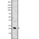Western blot analysis of NRAS using mouse liver lysates.