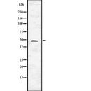 Western blot analysis of CASP2 using K562 whole  lysates.