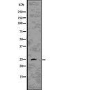 Western blot analysis of RHOQ using COLO205 whole  lysates.