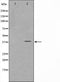Western blot analysis on Jurkat cell lysate using FKBPL Antibody