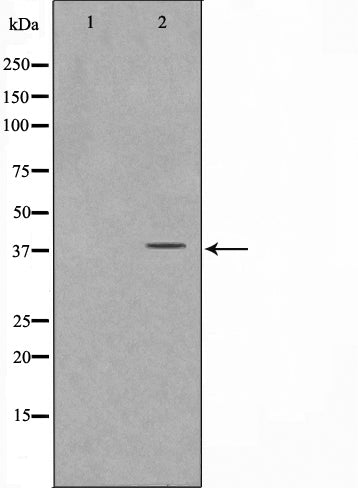 Western blot analysis on Jurkat cell lysate using FKBPL Antibody
