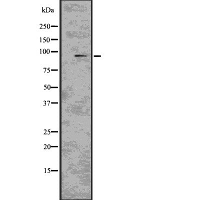 DF7646 staining Hela by IF/ICC. The sample were fixed with PFA and permeabilized in 0.1% Triton X-100,then blocked in 10% serum for 45 minutes at 25¡ãC. The primary antibody was diluted at 1/200 and incubated with the sample for 1 hour at 37¡ãC. An  Alexa Fluor 594 conjugated goat anti-rabbit IgG (H+L) Ab, diluted at 1/600, was used as the secondary antibod