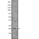 Western blot analysis of extracts from mouse heart, using ARF1 Antibody.