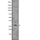 DF7652 staining HepG2 by IF/ICC. The sample were fixed with PFA and permeabilized in 0.1% Triton X-100,then blocked in 10% serum for 45 minutes at 25¡ãC. The primary antibody was diluted at 1/200 and incubated with the sample for 1 hour at 37¡ãC. An  Alexa Fluor 594 conjugated goat anti-rabbit IgG (H+L) Ab, diluted at 1/600, was used as the secondary antibod