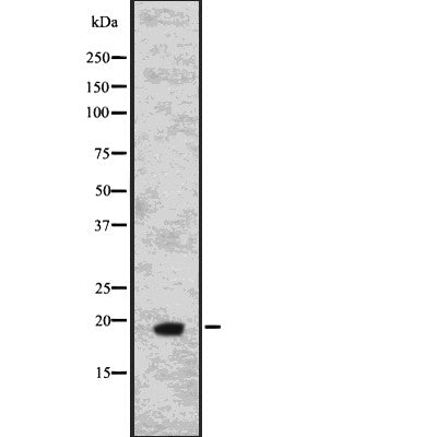 DF7654 at 1/100 staining Mouse lung tissue by IHC-P. The sample was formaldehyde fixed and a heat mediated antigen retrieval step in citrate buffer was performed. The sample was then blocked and incubated with the antibody for 1.5 hours at 22¡ãC. An HRP conjugated goat anti-rabbit antibody was used as the secondary