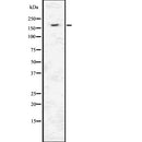 DF7656 staining HepG2 by IF/ICC. The sample were fixed with PFA and permeabilized in 0.1% Triton X-100,then blocked in 10% serum for 45 minutes at 25¡ãC. The primary antibody was diluted at 1/200 and incubated with the sample for 1 hour at 37¡ãC. An  Alexa Fluor 594 conjugated goat anti-rabbit IgG (H+L) Ab, diluted at 1/600, was used as the secondary antibod