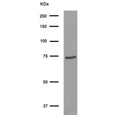 Western blot analysis of extracts from various samples, using FOXJ3 Antibody.
 Lane 1: Hybridoma cells, treated with blocking peptide;
 Lane 2: Hybridoma cells;
 Lane 3: Mouse  lung.