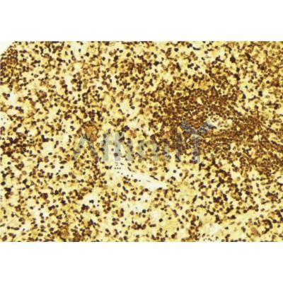 AF0179 at 1/100 staining Mouse spleen tissue by IHC-P. The sample was formaldehyde fixed and a heat mediated antigen retrieval step in citrate buffer was performed. The sample was then blocked and incubated with the antibody for 1.5 hours at 22¡ãC. An HRP conjugated goat anti-rabbit antibody was used as the secondary