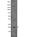 Western blot analysis of MYCB using K562 whole  lysates.