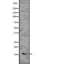 Western blot analysis of CENPA using LOVO whole  lysates.