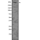 Western blot analysis of HTT using HuvEc whole  lysates.