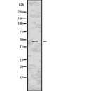 DF7664 staining HeLa cells by IF/ICC. The sample were fixed with PFA and permeabilized in 0.1% Triton X-100,then blocked in 10% serum for 45 minutes at 25¡ãC. The primary antibody was diluted at 1/200 and incubated with the sample for 1 hour at 37¡ãC. An  Alexa Fluor 594 conjugated goat anti-rabbit IgG (H+L) antibody(Cat.