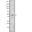 DF7666 staining Hela by IF/ICC. The sample were fixed with PFA and permeabilized in 0.1% Triton X-100,then blocked in 10% serum for 45 minutes at 25¡ãC. The primary antibody was diluted at 1/200 and incubated with the sample for 1 hour at 37¡ãC. An  Alexa Fluor 594 conjugated goat anti-rabbit IgG (H+L) Ab, diluted at 1/600, was used as the secondary antibod
