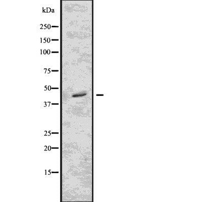 DF7666 staining Hela by IF/ICC. The sample were fixed with PFA and permeabilized in 0.1% Triton X-100,then blocked in 10% serum for 45 minutes at 25¡ãC. The primary antibody was diluted at 1/200 and incubated with the sample for 1 hour at 37¡ãC. An  Alexa Fluor 594 conjugated goat anti-rabbit IgG (H+L) Ab, diluted at 1/600, was used as the secondary antibod