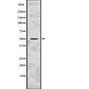 Western blot analysis of MAP2K5 using K562 whole  lysates.