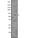 DF7669 at 1/100 staining Human liver cancer tissue by IHC-P. The sample was formaldehyde fixed and a heat mediated antigen retrieval step in citrate buffer was performed. The sample was then blocked and incubated with the antibody for 1.5 hours at 22¡ãC. An HRP conjugated goat anti-rabbit antibody was used as the secondary