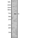 Western blot analysis of AURKC using K562 whole  lysates.