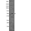 Western blot analysis of CHGA using LOVO whole  lysates.