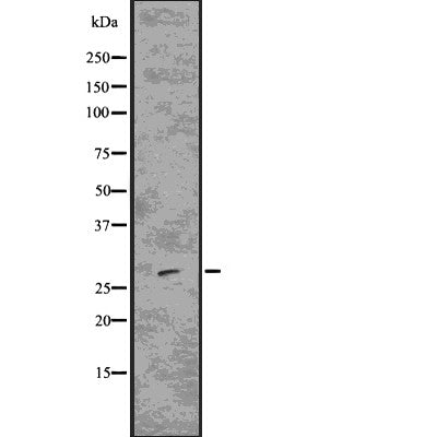 DF7674 staining HeLa by IF/ICC. The sample were fixed with PFA and permeabilized in 0.1% Triton X-100,then blocked in 10% serum for 45 minutes at 25¡ãC. The primary antibody was diluted at 1/200 and incubated with the sample for 1 hour at 37¡ãC. An  Alexa Fluor 594 conjugated goat anti-rabbit IgG (H+L) Ab, diluted at 1/600, was used as the secondary antibod