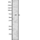 Western blot analysis of KCND2 using MCF7 whole  lysates.