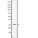 DF7676 staining Hela by IF/ICC. The sample were fixed with PFA and permeabilized in 0.1% Triton X-100,then blocked in 10% serum for 45 minutes at 25¡ãC. The primary antibody was diluted at 1/200 and incubated with the sample for 1 hour at 37¡ãC. An  Alexa Fluor 594 conjugated goat anti-rabbit IgG (H+L) Ab, diluted at 1/600, was used as the secondary antibod