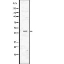Western blot analysis of ACTC1 using Jurkat whole  lysates.