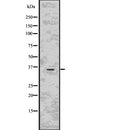 DF7678 staining HepG2 by IF/ICC. The sample were fixed with PFA and permeabilized in 0.1% Triton X-100,then blocked in 10% serum for 45 minutes at 25¡ãC. The primary antibody was diluted at 1/200 and incubated with the sample for 1 hour at 37¡ãC. An  Alexa Fluor 594 conjugated goat anti-rabbit IgG (H+L) Ab, diluted at 1/600, was used as the secondary antibod