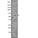 DF7682 staining HepG2 by IF/ICC. The sample were fixed with PFA and permeabilized in 0.1% Triton X-100,then blocked in 10% serum for 45 minutes at 25¡ãC. The primary antibody was diluted at 1/200 and incubated with the sample for 1 hour at 37¡ãC. An  Alexa Fluor 594 conjugated goat anti-rabbit IgG (H+L) Ab, diluted at 1/600, was used as the secondary antibod