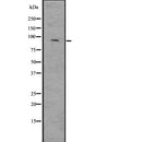 DF7683 staining HEPG2 cells by ICC/IF. Cells were fixed with PFA and permeabilized in 0.1% saponin prior to blocking in 10% serum for 45 minutes at 37¡ãC. The primary antibody was diluted 1/200 and incubated with the sample for 1 hour at 37¡ãC. A  Alexa Fluor 594 conjugated goat polyclonal to rabbit IgG (H+L), diluted 1/600 was used as secondary antibod