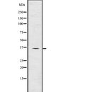 Western blot analysis of TIRAP using K562 whole  lysates.